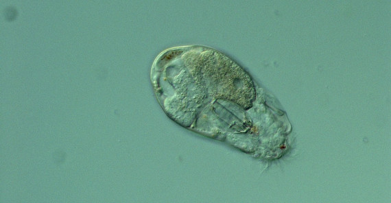 Rädertierchen Rädertierchen