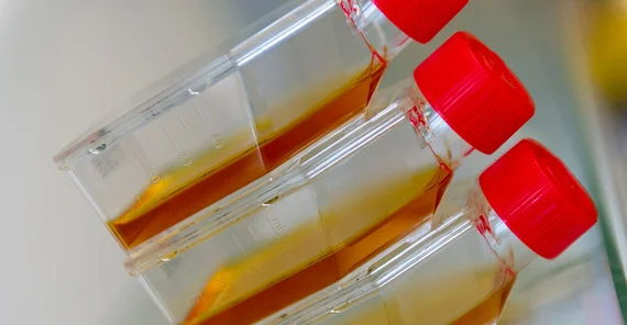 Zellkulturflasche | Foto: Tobias Hopfgarten