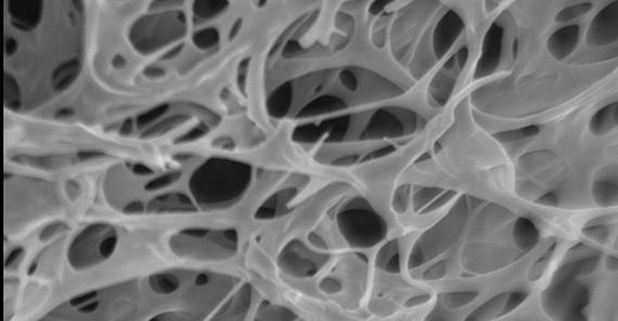 Rasterelektronenmikroskopische Aufnahme eines Polyglutaminsäure Hydrogels. Fotografie: Charlotte Vacogne (Max-Planck-Institut für Kolloid- und Grenzflächenforschung)