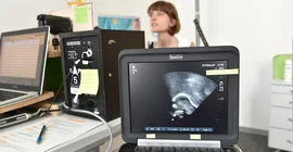 The experiments investigate the movement of the tongue, among other things. Photo: Karla Fritze