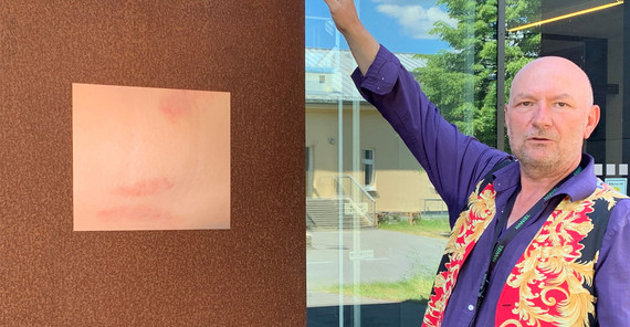 Ruppe Koselleck mit einer Arbeit zum Thema „Haut“ von Studentin Elisabeth Riesenhuber an der Rostfassade des Inklusionsgebäudes Haus 31 auf dem Uni-Campus Golm | Foto: A. Horn-Conrad Ruppe Koselleck mit einer Arbeit zum Thema „Haut“ von Studentin Elisabeth Riesenhuber an der Rostfassade des Inklusionsgebäudes Haus 31 auf dem Uni-Campus Golm | Foto: A. Horn-Conrad
